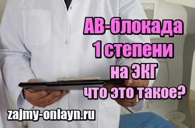 АВ-блокада 1 степени на ЭКГ – что это такое