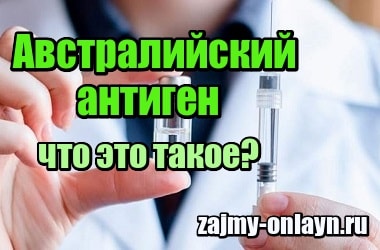 Австралийский антиген – что это такое, где заражаются