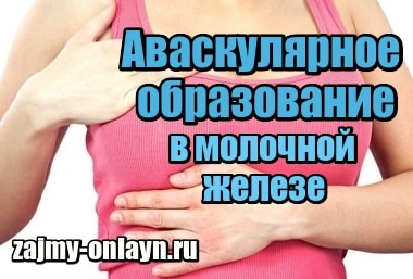 Аваскулярное образование в молочной железе – что это такое