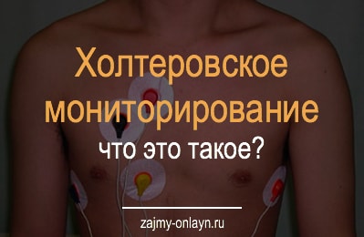 Холтеровское мониторирование — что это такое?