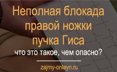 Неполная блокада правой ножки пучка Гиса — что это такое, чем опасно?